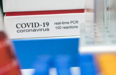 PCR, Antígeno, anticuerpo